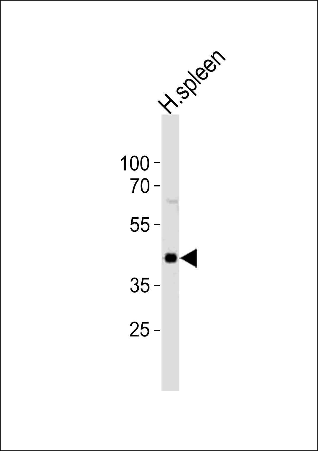WB - CHST12 Antibody (N-term) AP21028b